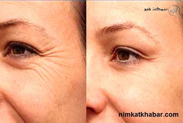 ترفند مراقبت از زیبایی چشم برای جوان ماندن و طراوت آنها