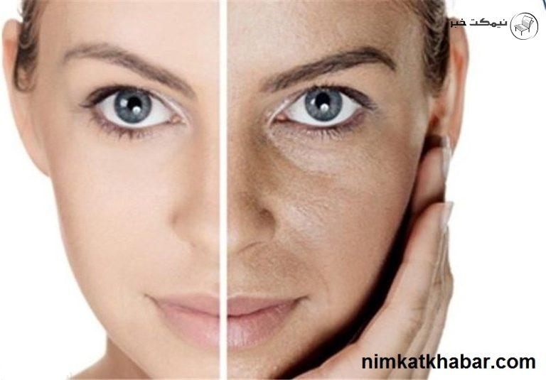 برطرف کردن تیرگی های پوست بدون استفاده از مواد شیمیایی