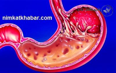 مواد غذایی که میل به خوردن را کاهش میدهد و ماهیت اسیدی دارند