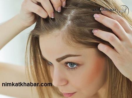 روش جلوگیری از موخوره زدن و ریزش مو و ترفند تقویت موی سر