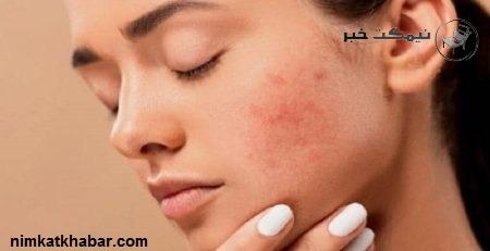 کم کردن چین و چروک های صورت و روش های مراقبت کردن از پوست