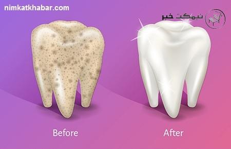 روش های سفید کردن دندان با استفاده از تغییراتی در روتین روزانه