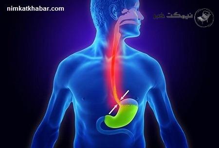 روش پیشگیری از رفلاکس معده با استفاده از چند پیشنهاد ساده