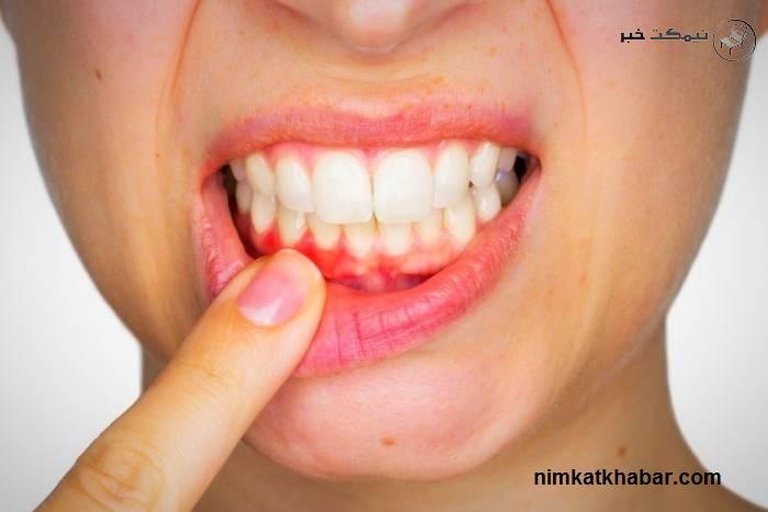 تهیه دهانشویه با چای سبز تهیه دهانشویه با استفاده از چای سبز در خانه + فواید دهانشویه چای سبز