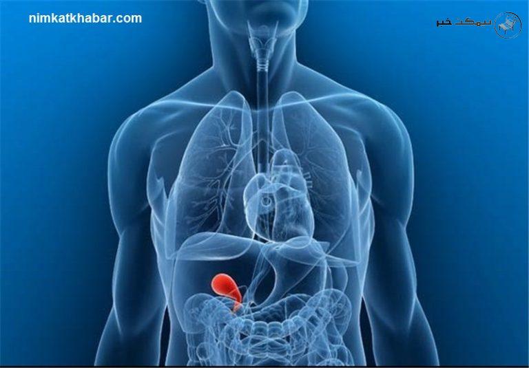 نکاتی برای تضمین سلامت کیسه صفرا و جلوگیری از بروز بیماری های احتمالی