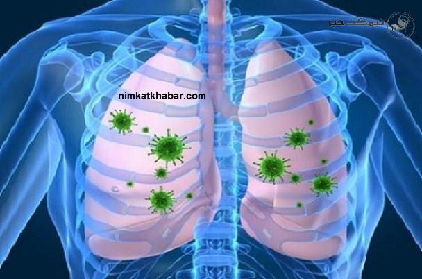 نشانه عفونت ریه ها در افراد که این بیمار را هشدار میدهد + درمان خانگی