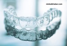 اطلاعاتی درباره ارتودنسی دندان بدون سیم کشی و پاسخ به این پرسش پرتکرار