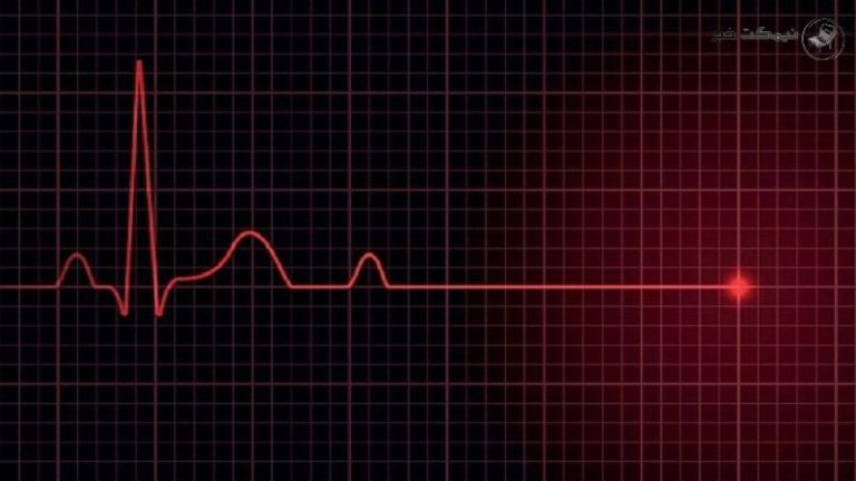 مهم ترین و اصلی ترین دلایل ایست قلبی در خواب را بدانید + جزئیات