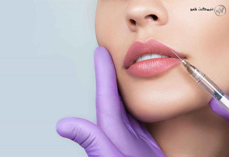 انواع مدل های ژل لب