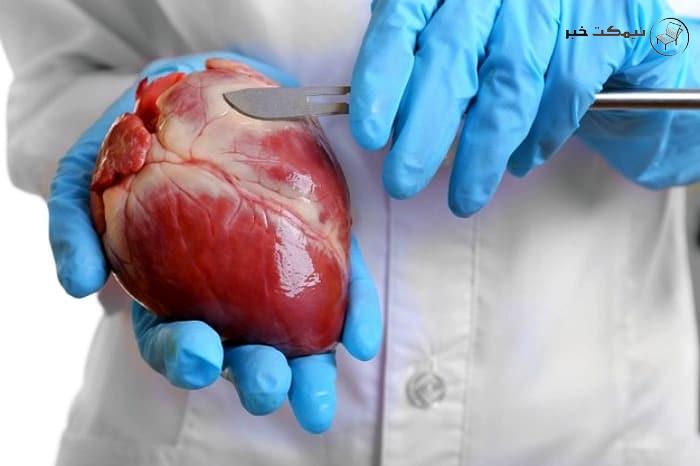 جراحی قلب 