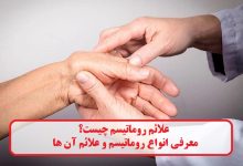 علائم روماتیسم چیست؟ معرفی انواع روماتیسم و علائم آن ها علائم روماتیسم
