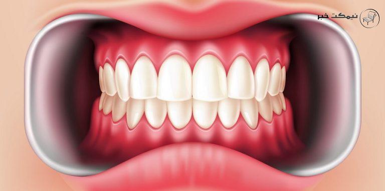 برای داشتن دندان سالم تر چه روشی مناسب است