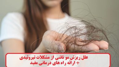 علل ریزش مو ناشی از مشکلات تیروئیدی + ارائه راه های درمانی مفید علل ریزش مو ناشی از مشکلات تیروئیدی