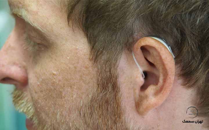 بهترین کلینیک شنوایی سنجی بهترین کلینیک شنوایی سنجی