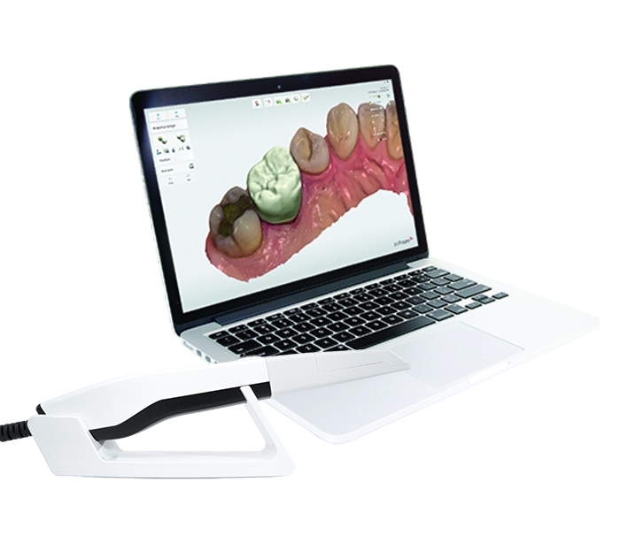 اسکنر داخل دهانی (Intraoral Scanner) اسکنر داخل دهانی (Intraoral Scanner)