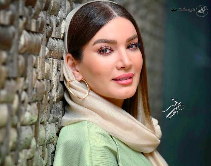 عکس متین ستوده قبل از عمل‌ های زیبایی که پربازدید شد
