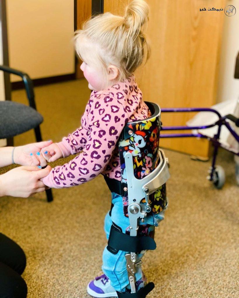 چرا لنگیدن کودک زنگ خطر یک بیماری پنهان است؟